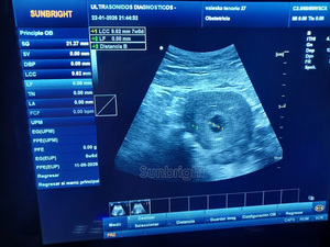 Ecógrafo <span class=keywords><strong>Doppler</strong></span> Color 3D Profesional para Uso Médico, con Función PW, para Uso Clínico - Product Image 2