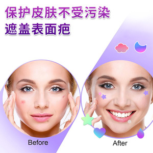 Patchs anti-acné laser colorés en forme d'étoile, fins et respirants, traitement de l'acné pour adolescents et adultes - Product Image 3