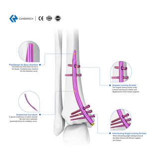Clou Tibial Distal DTN avec Embout de 0 mm, Dispositif Médical Implantable CE ISO pour Distributeurs Orthopédiques - Product Image 1