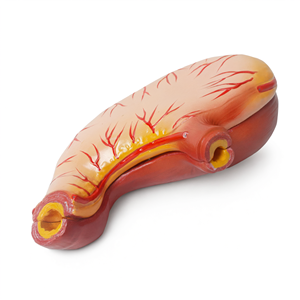 Modelo Anatómico de Úlcera Gástrica Enferma de PVC, Tamaño Natural, para Enseñanza y Demostración Médica y Biológica - Product Image 3
