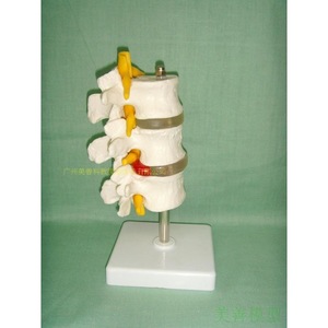 Modèle de colonne lombaire normale combiné ; Modèle de colonne lombaire en 3 sections ; Modèle de colonne lombaire en 3 sections ; Modèle de colonne lombaire en 4 sections - Product Image 2
