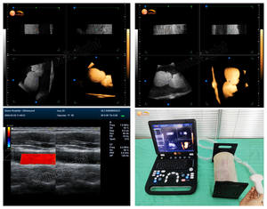 Portátil portátil Color Ultrasonido Escáner Máquina 3D Notebook tipo ultrasonido - Product Image 6