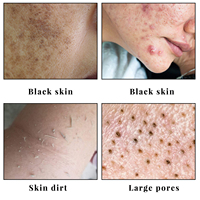 Savon à l'Acide Kojique Blancheur en 7 Jours, Cosmétiques Éclaircissants pour la Peau, Savon Corporel Blanchissant et Éclaircissant pour le Visage, Marque Privée