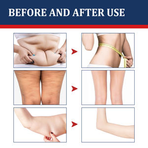 Sabuk perut pembakar lemak Herbal China, sabuk perut penurun berat badan, plester pembakar lemak, patch pusar Herbal China, harga pabrik - Product Image 3