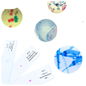 Portaobjetos de microscopio preparados con huevos de lombriz, muestras biológicas médicas para <span class=keywords><strong>la</strong></span> enseñanza de ciencias para niños y educación en el hogar - Product Image 4