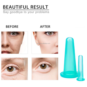 <span class=keywords><strong>Celulitis</strong></span> Kit Forma Mejillas Linfático Fascia Masajeador Terapia Facial Ventosas Copas - Product Image 3