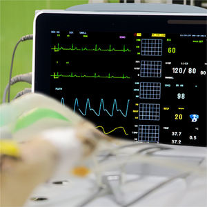 12 Inch Draagbare Handheld Vitale Functies Monitor Met Klein Formaat En Eenvoudige Bediening Pulsoximetrie Veterinaire Bedrijfsapparatuur - Product Image 3