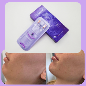 Distributeur mondial : Produits personnalisés pour une remplissage profond et une perfection de la forme <span class=keywords><strong>des</strong></span> tempes, <span class=keywords><strong>des</strong></span> contours de nez élégants. Livraison gratuite. - Product Image 2