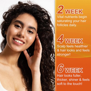 OEM Private Label Suiker-vrije Pompoenzaadolie Gummies met Saw Palmetto Extract voor Volwassen Prostaatgezondheid & Urineondersteuning - Product Image 4