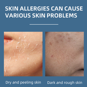 מותאם אישית 50 מ "ל אופתלמולוגי ג 'ל עיצוב אקרילי עור ארוך טווח עם מקור - Product Image 3