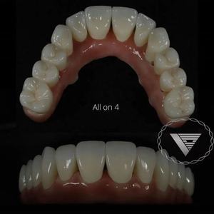 MIIYEN bloc de zircone laboratoire <span class=keywords><strong>dentaire</strong></span> <span class=keywords><strong>dents</strong></span> de zircone esthétique 3D Pro multicouche pré-colorée blocs de zircone de laboratoire <span class=keywords><strong>dentaire</strong></span> - Product Image 6