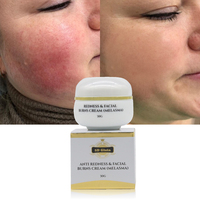 Crème Éclaircissante Puissante et Efficace pour le Visage, Réduit les Rougeurs et les Brûlures, Anti-Taches de Rousseur, Atténue le Mélasma et les Taches Foncées
