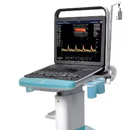 Échographe Doppler Couleur Portable SonoScape S9 Pro avec Batterie Intégrée pour Hôpital - Product Image 2