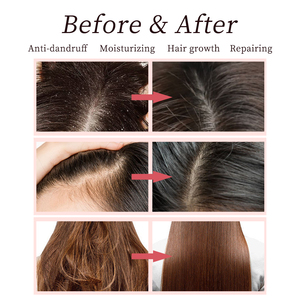 Champú orgánico <span class=keywords><strong>con</strong></span> aceite <span class=keywords><strong>de</strong></span> argán para el crecimiento del cabello, sin sulfatos, Vegano, <span class=keywords><strong>aloe</strong></span> <span class=keywords><strong>vera</strong></span>, arroz, <span class=keywords><strong>biotina</strong></span>, anti caída del cabello, marca blanca, OEM - Product Image 4