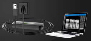 เครื่องเอ็กซ์เรย์ดิจิตอลทันตกรรมแบบพกพาประเภทกล้องเอ็กซ์เรย์ไร้สายอินเวอร์เตอร์ความถี่สูงมือถือเอ็กซ์เรย์ทันตกรรมและเซ็นเซอร์ RVG - Product Image 6