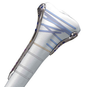 Instruments chirurgicaux pour traumatismes, kit d'instruments chirurgicaux pour traumatismes durables, autoclavables, réutilisables, en acier inoxydable, pour professionnels - Product Image 3