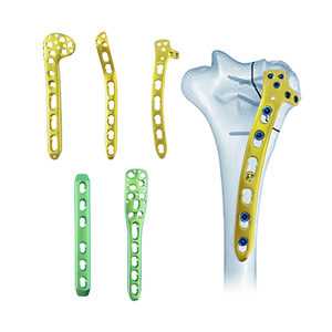 Placa de Bloqueo Humeral <span class=keywords><strong>Proximal</strong></span> de Alta Calidad, Implante Ortopédico de Titanio para Fijación Quirúrgica de Fracturas de Húmero - Product Image 1