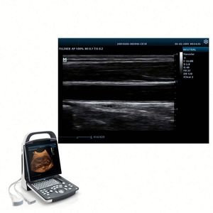 Instrumento de ultrasonido médico DP20 2D Color Doppler Ultrasonido Uso humano Digital <span class=keywords><strong>Mindray</strong></span> BW Ultrasonido - Product Image 3