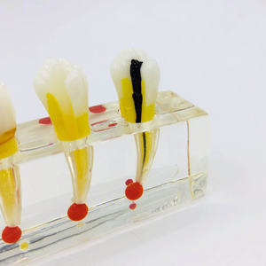 Riparazione della polpa dentale modello orale per la visualizzazione e la comunicazione - Product Image 6