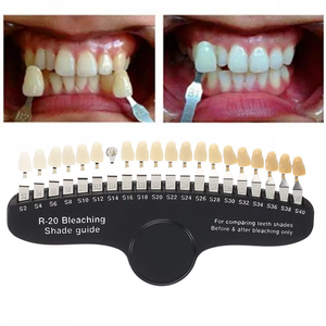 Guide d'ombre de prothèse dentaire <span class=keywords><strong>en</strong></span> <span class=keywords><strong>céramique</strong></span> pour le blanchiment des dents - Product Image 6