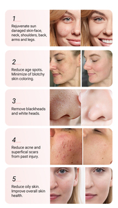 Jet d'oxygène 14in1 Super Bubble pour un rajeunissement de la peau en profondeur Équipement de beauté spa - Product Image 5