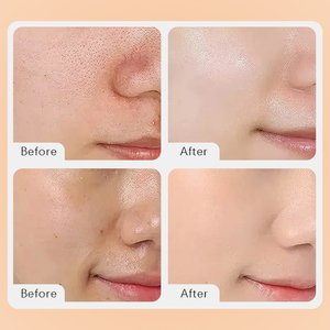 Etiqueta privada Ácido glicólico 5% Solución tonificante Exfoliar Hidratante Brillo Tónico Glicólico para la piel - Product Image 4