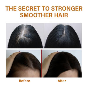 <span class=keywords><strong>Mascarilla</strong></span> para el cabello afroamericana Etiqueta privada Sin sulfato El <span class=keywords><strong>mejor</strong></span> champú de jengibre Champú para la caída del cabello para mujeres Hombres - Product Image 5