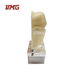 แบบจำลอง<span class=keywords><strong>ฟัน</strong></span><span class=keywords><strong>ฟัน</strong></span>กรามที่มีเส้นประสาท6ครั้ง - Product Image 6