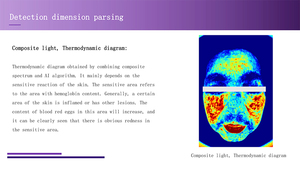 <span class=keywords><strong>2025</strong></span> nouveauté Woods lampe peau santé peau Type détecteur analyseur de peau - Product Image 6