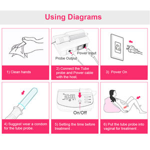 Dispositivo de Terapia para Uso Doméstico para la Erosión Cervical, Vaginitis No Específica Leve <span class=keywords><strong>y</strong></span> Enfermedad Inflamatoria Pélvica - Product Image 6