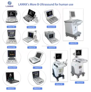 LANNX uRason N8 Instrument médical Machine à ultrasons Doppler portable ordinateur portable Scanner à ultrasons numérique noir et blanc