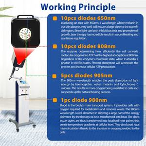 Peralatan Terapi Laser Kelas 4 untuk Fisioterapi Lutut, Osteoarthritis, <span class=keywords><strong>Arthritis</strong></span>, Pengobatan, Terapi, Rehabilitasi Tulang Belakang, Fisioterapia - Product Image 2