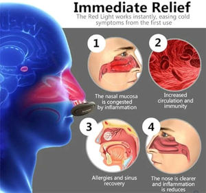 Dispositivo de Terapia Nasal Elétrico Anti Ronco Tratamento Calmante de Sinusite Dispositivo de Terapia Nasal Recarregável Dilatador Nasal - Product Image 2