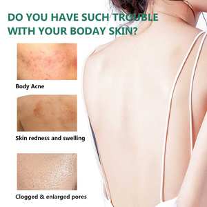 สเปรย์รักษาสิวเพื่อเพิ่มความชุ่มชื้นให้ผิวลดอาการบวมและแดงช่วยผ่อนคลายรูขุมขนและ<span class=keywords><strong>หลัง</strong></span>ร่างกาย - Product Image 3