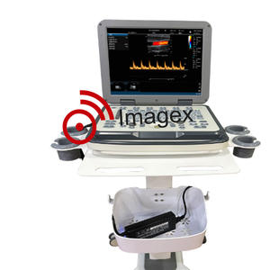 Sistem <span class=keywords><strong>Combo</strong></span> <span class=keywords><strong>Ultrasound</strong></span> Doppler hitam & putih Laptop - Product Image 2
