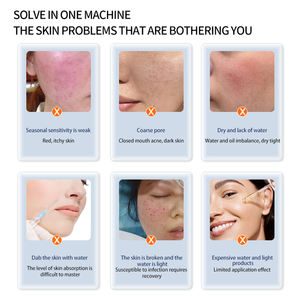 Dispositivo Portátil de Microburbujas para el Cuidado de la Piel, Limpieza Facial con Control de Pantalla Táctil y Pieza de Mano de Inyección de Precisión - Product Image 5