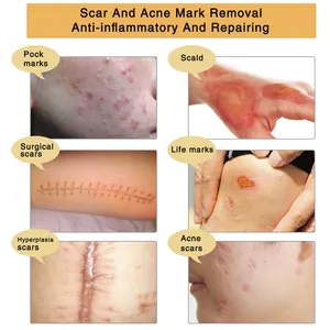 TCM удаление шрамов и следов от прыщей, клеточная мазь, противовоспалительный и восстанавливающий крем для восстановления кожи лица и тела