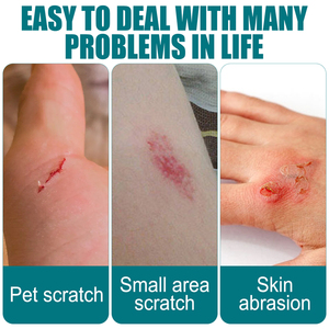 สายเจลแบบพัน<span class=keywords><strong>แผล</strong></span>สำหรับซ่อมแซมรอย<span class=keywords><strong>ถลอก</strong></span>10มล. ลายดวงจันทร์ตอนใต้ฉลากตามต้องการ - Product Image 3