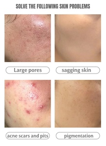 Exfoliante Facial, Exfoliante con Algas, Exfoliante Químico para el Rostro, Otros Productos de Belleza y Cuidado Personal - Product Image 4