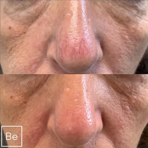 Macchina di irradiazione Laser per via endovenosa Desktop portatile per le vene Varicose e rimozione delle vene del ragno rimozione dei vasi sanguigni 980Nm - Product Image 6