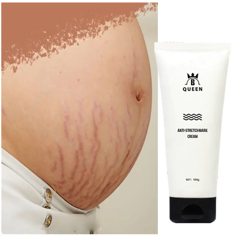 Body beauty cream private label anti stretch mark oil stretch marks removal cream for skin care
