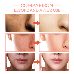 Suero Facial Antienvejecimiento 5 en <span class=keywords><strong>1</strong></span>, Suero de Niacinamida, Suero Antienvejecimiento con <span class=keywords><strong>Retinol</strong></span> y Vitamina C - Product Image 4