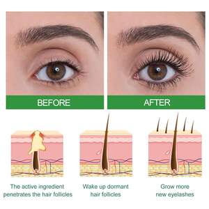 Logo kustom Roll on minyak rambut minyak kastor perawatan penumbuh kembali <span class=keywords><strong>Dht</strong></span> pemblokir perawatan rambut untuk rambut rusak - Product Image 2