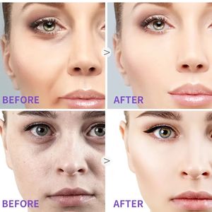 من أجل د راشيل سيروم العناية بالوجه مضاد للشيخوخة ، سيروم أوركيد وبذور نبتة من الكروم ، مبيض للاسترخاء للبشرة - Product Image 3