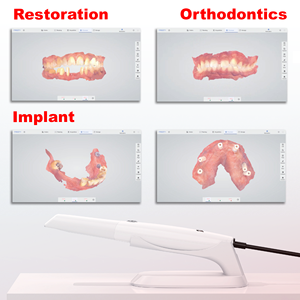 <span class=keywords><strong>Prix</strong></span> Distributeur - Scanner Intraoral Intelligent Panda P5 pour la Dentisterie ou l'Industrie Intraorale - Alliage d'Aluminium Aéronautique Classe II - Product Image 5