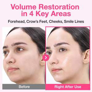 Masque repulpant au collagène PDRN et à l'extrait de rose n°2 (5 pièces) - Rajeunissement et hydratation de la peau pour les teints ternes et fatigués - Product Image 4