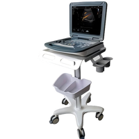 Appareils de diagnostic ultrasonores portables, échographe Doppler couleur cardiaque et vasculaire
