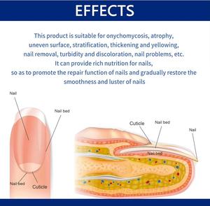 Nuevo Sérum Reparador para Uñas, Tratamiento para <span class=keywords><strong>Hongos</strong></span>, Cuidado de Uñas Dañadas, Crema Natural para Uñas de Pies y Manos <span class=keywords><strong>en</strong></span> <span class=keywords><strong>Piel</strong></span> Sensible - Product Image 5