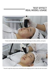 Professionelles R&F Hautstraffungs- und Verjüngungsgerät Heiß-Kalt-Hammer Augenlifting <span class=keywords><strong>Anti</strong></span>-Falten Gesichtspflege Schönheitsgerät - Product Image 6