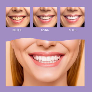 Pó Clareador de Dentes Roxo Eficaz, Mousse de Carvão para Limpeza Profunda de Tártaro Oral, Clareamento da Dentina, Cuidado Delicado com a Boca 60ml para Uso Doméstico - Product Image 3